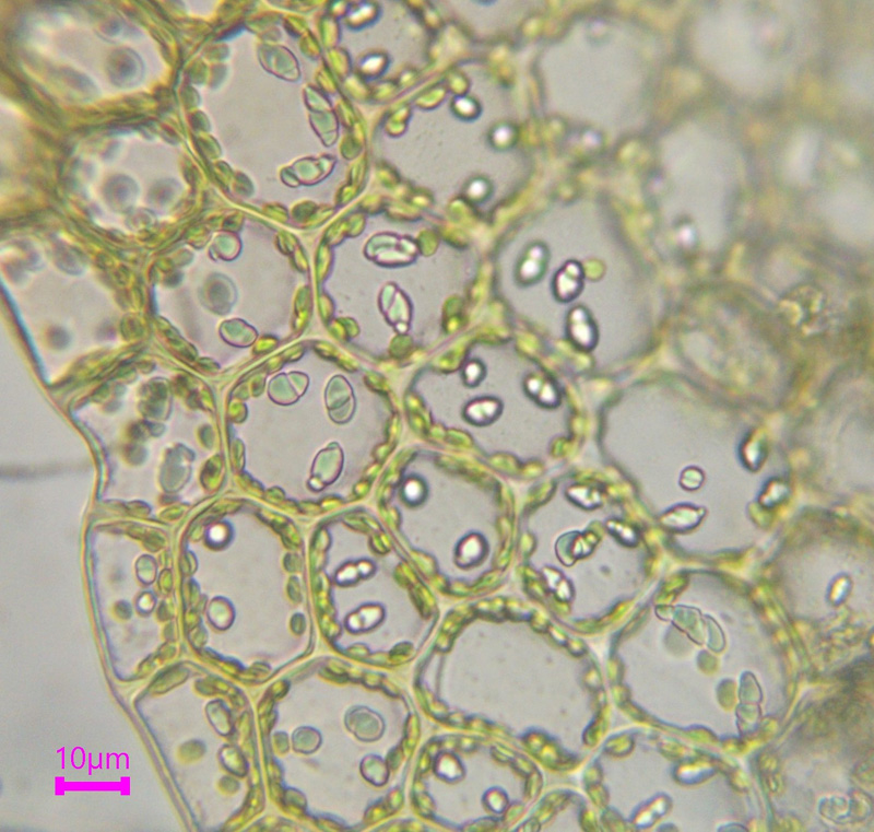 Calypogeia suecica